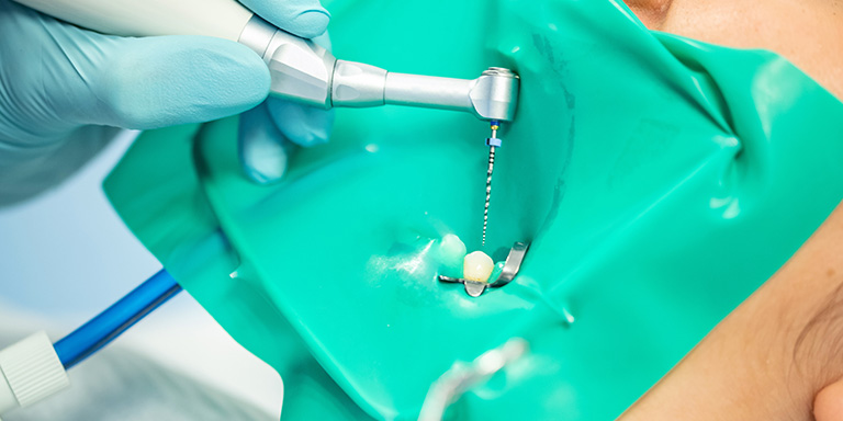 Guia Completo Da Endodontia | Dental Office