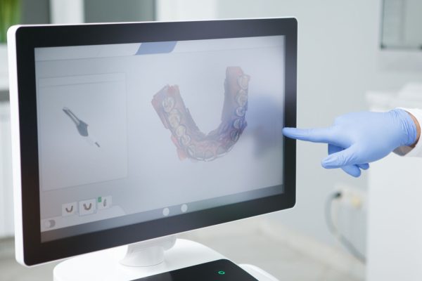 Inteligência artificial na odontologia: o que mudou com a IA?