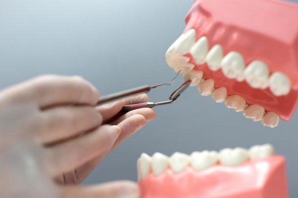 Guia completo sobre implantes dentários com dicas para atrair pacientes na área de Implantodontia